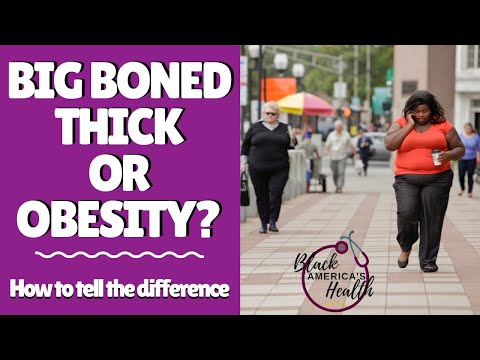 Big Boned, Thick or Obesity – how thick is too unhealthy?