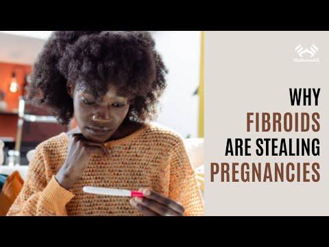 How Fibroids Can Cause A Miscarriage