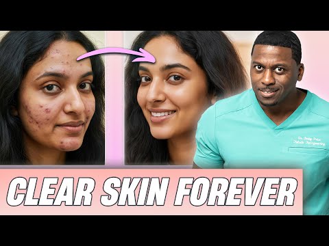 The Secret To Clear Skin Revealed (Acne, Wrinkles, Age Spots)