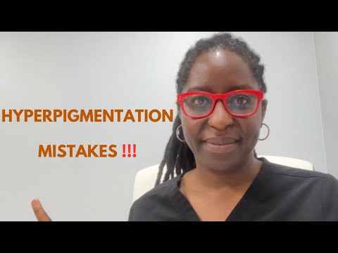 5 Hyperpigmentation Mistakes You are making that worsen your skin.