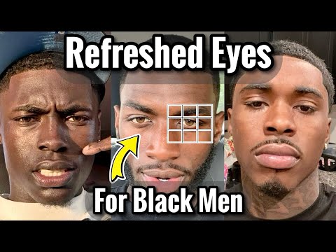 How to Get Rid of Eye Bags and Dark Circles for Black Men