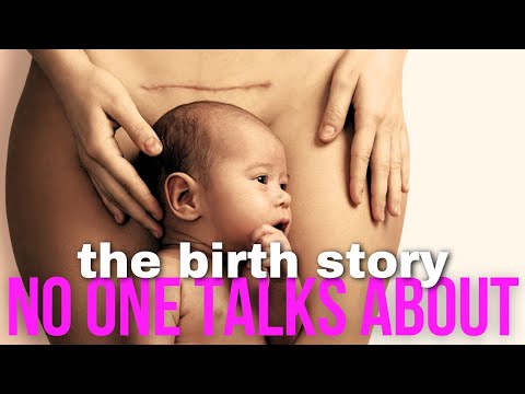 Why Are Moms Choosing C-Sections?