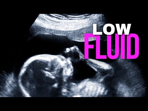 14 | Labor Prep 101: Real Stories From Black Mothers