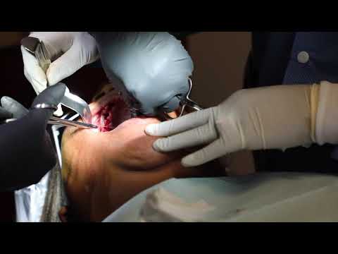 Dr  Heavenly Surgery Part 3   Closure