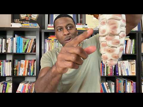 4 Plant Medicines BIG Pharma Doesn’t Want You To Know About