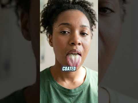 Yeast Overgrowth Is RUINING Your Gut!