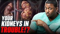 5 Toxins Poisoning Your Kidneys (Your Doctor WON’T Tell You This)