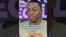Dark Spots May Signal Something Deeper